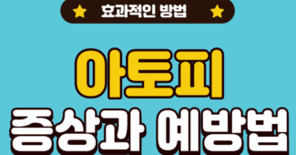 아토피성 피부염의 증상과 예방법, 치료방법