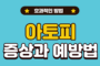 아토피성 피부염의 증상과 예방법, 치료방법